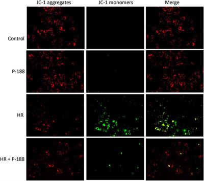 Poloxamer 188 Attenuates Ischemia-Reperfusion-Induced Lung Injury by Maintaining Cell Membrane Integrity and Inhibiting Multiple Signaling Pathways